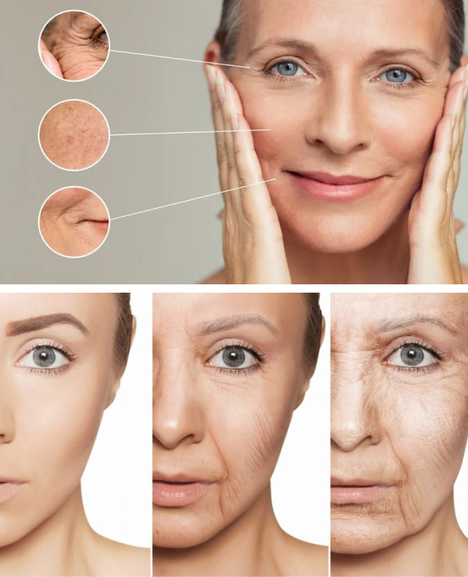 The Thread Lifting Treatment Process